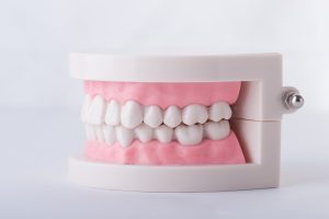 歯科模型